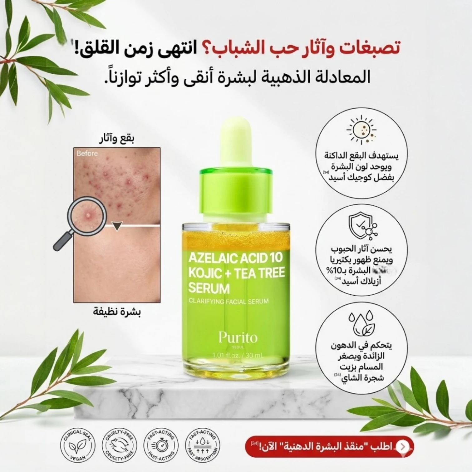 بيوريتو سيروم أزيلاك أسيد 10% مع كوجيك أسيد وزيت شجرة الشاي