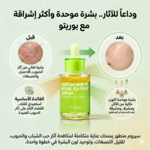 بيوريتو سيروم أزيلاك أسيد 10% مع كوجيك أسيد وزيت شجرة الشاي