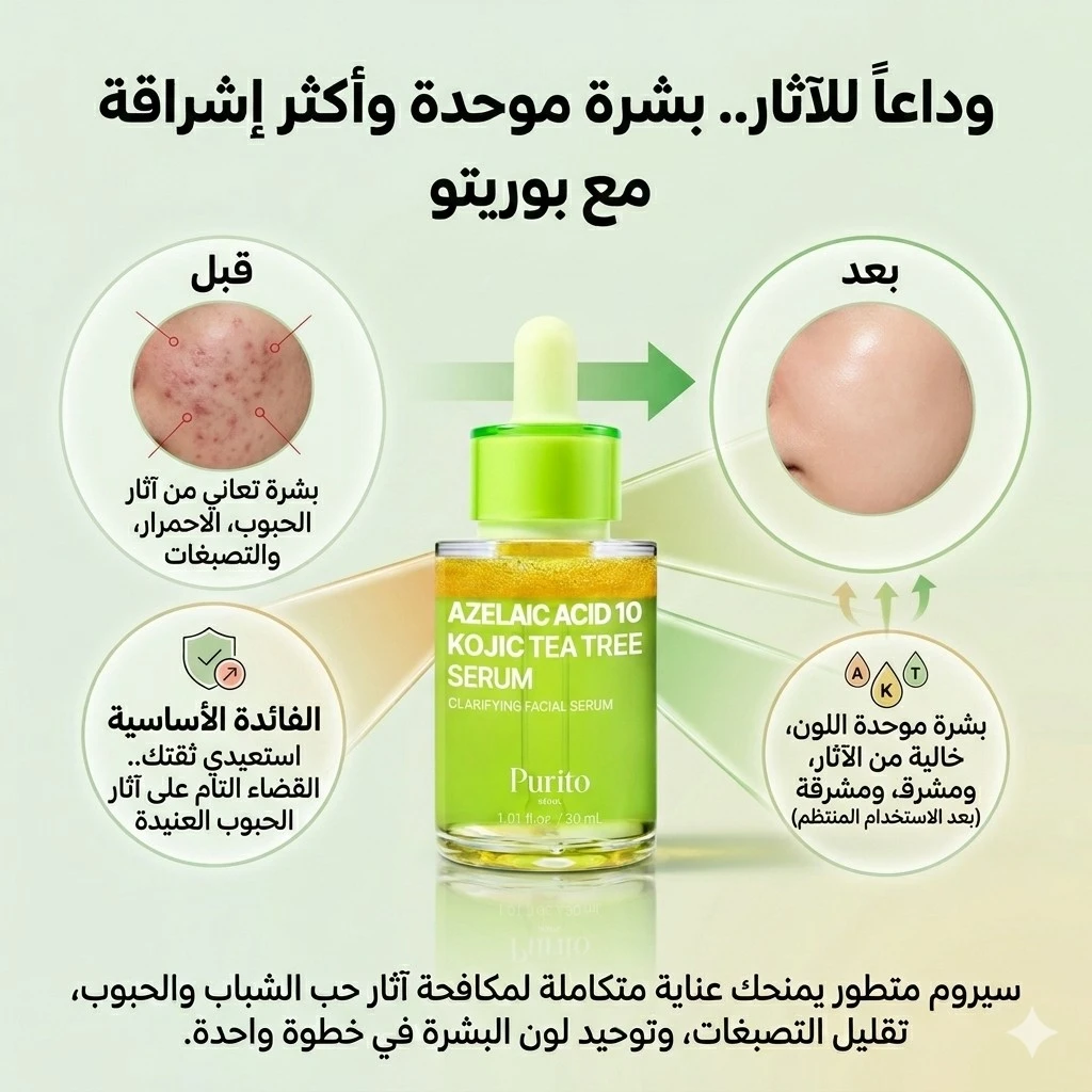 بيوريتو سيروم أزيلاك أسيد 10% مع كوجيك أسيد وزيت شجرة الشاي